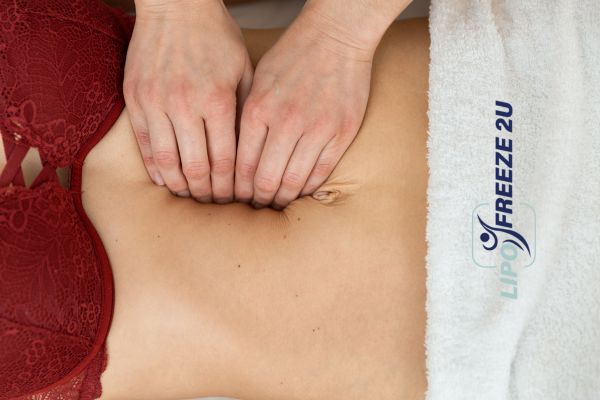 diastasis recti treatment Barnet