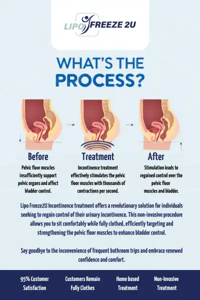 Diagram of how incontinence treatment Barnet works.
