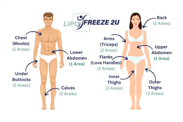 Areas you can have fat freezing treatment Barnet