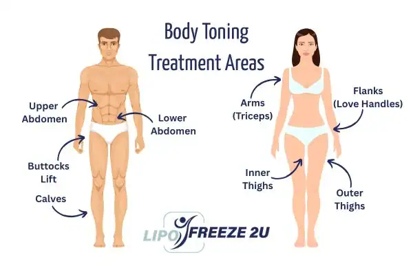 Graphic showing where you can have Body toning Treatment Barnet on your body