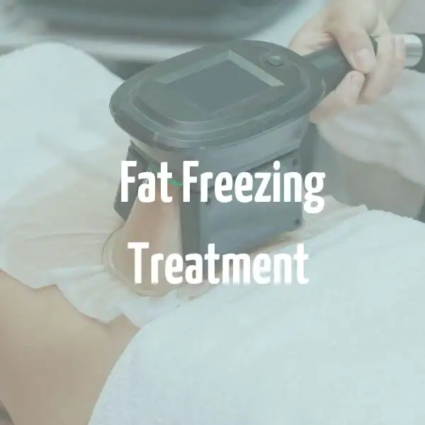 fat freezing treatment Barnet