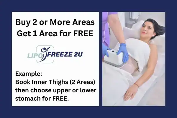 fat freezing prices Barnet