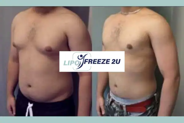 How Long Does It Take to See Results Barnet?