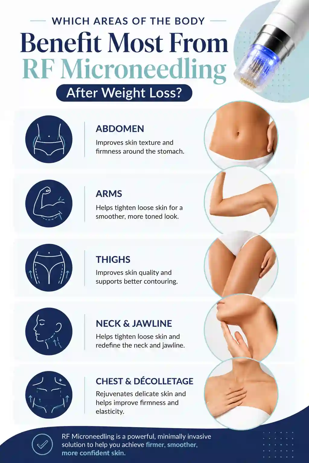 Which Areas of the Body Benefit Most From RF Microneedling After Weight Loss Barnet